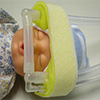 PRONG p/ CPAP Neonatal Newmed (pacote c/ 5 unidades) - Ref.: 52PRONG PRONG p/ CPAP Neonatal Newmed (pacote c/ 5 unidades) - Ref.: 52PRONG